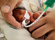 Cures Centrades en el Desenvolupament Neonatal i la Família