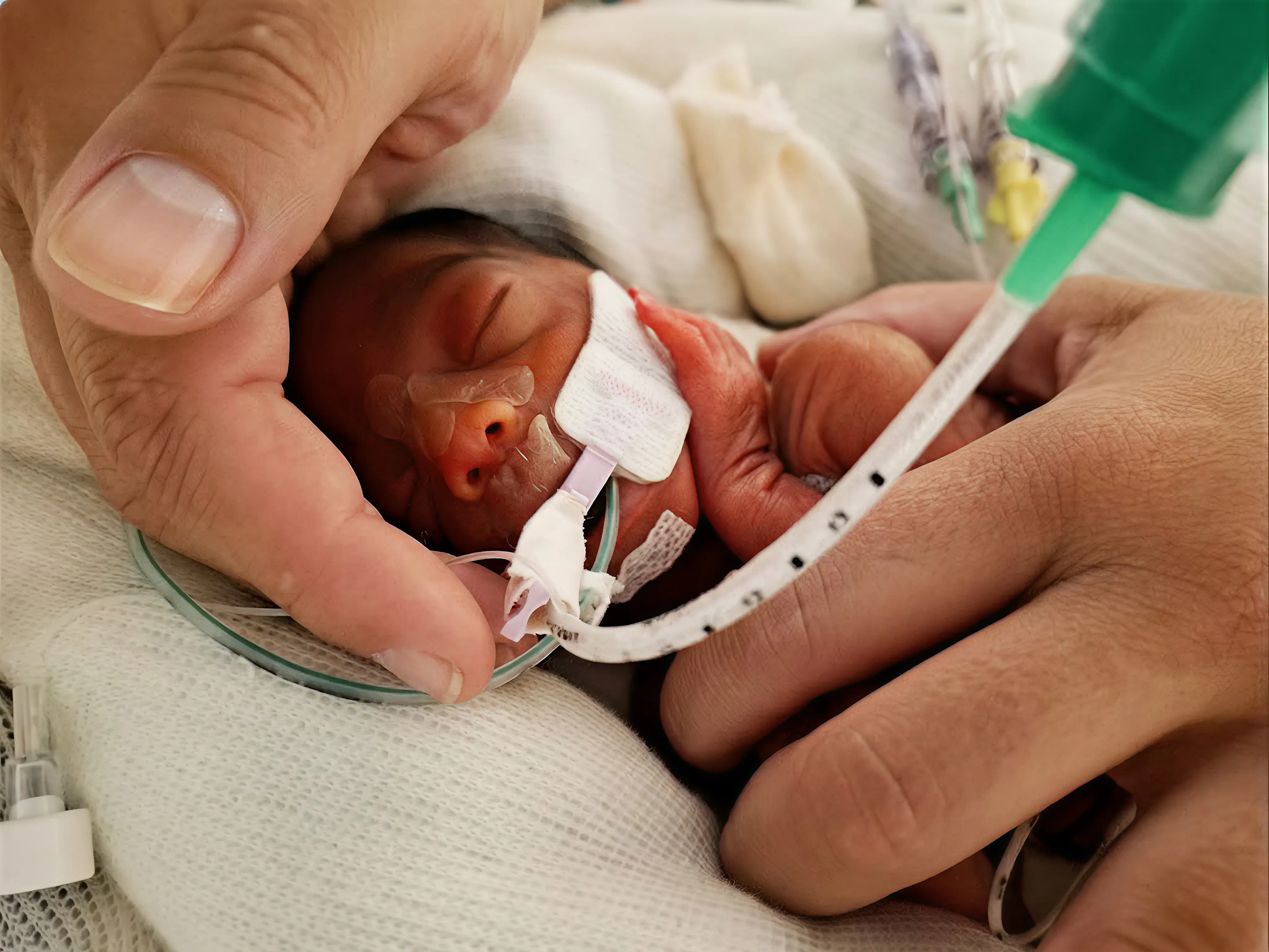 Cures Centrades en el Desenvolupament Neonatal i la Família: el nadó preterme d’alt risc